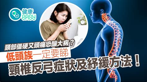 反弓|頸椎反弓：症狀、病因及如何治療